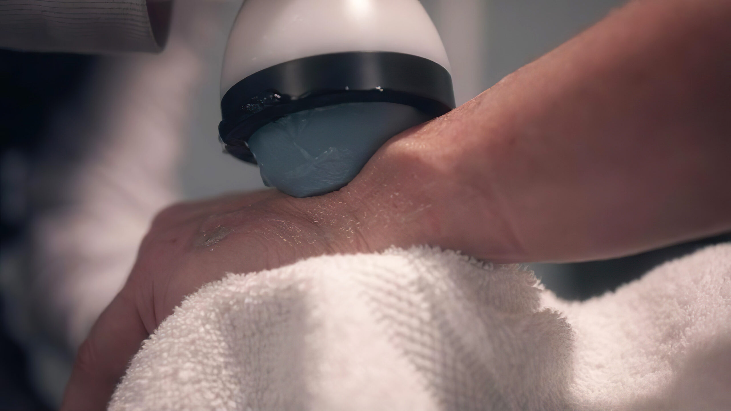 Dr Ravi - Stem Wave Therapy 10 (0-02-44-06) - Wrist